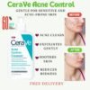 14 (2) CeraVe Acne Foaming Cream Cleanser – 4% Benzoyl Peroxide | Deep Pore Cleanser for Oily Acne-Prone Skin