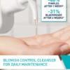 68882 Blemish Control Cleanser 700x875 v37.jpg Blemish Control Cleanser Salicylic acid cleanser for acne-prone skin
