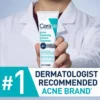 BPO4-number1-desktop-700x785-v1.jpg CeraVe Acne Foaming Cream Cleanser – Powerful 4% Benzoyl Peroxide Face Wash