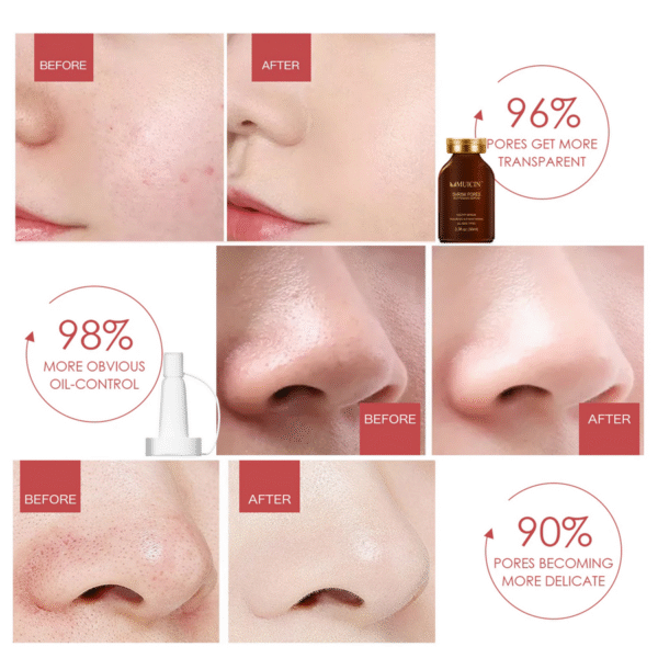 MUICIN Shrink Pores Hyaluronic Acid Serum - 30ml